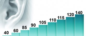 Fig. 2. Noise levels